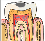 C1