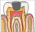 C2